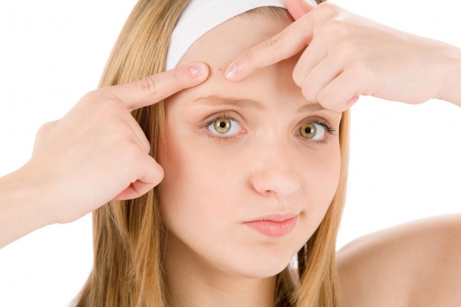 5 remedios caseros para eliminar el acné
