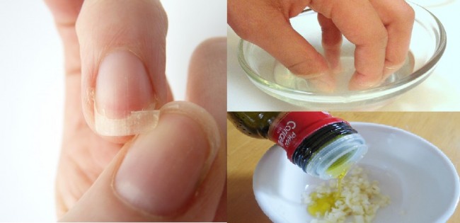 Mezclas naturales para aliviar las uñas quebradizas