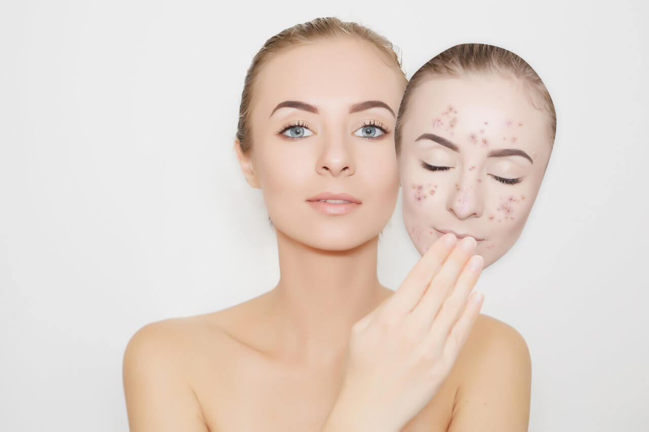 4 alternativas naturales para remover las manchas de tu piel