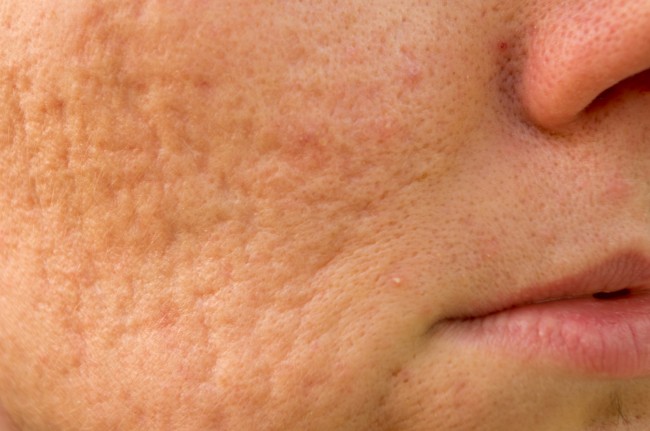 Descubre 3 tónicos faciales para cerrar los poros y suavizar la piel