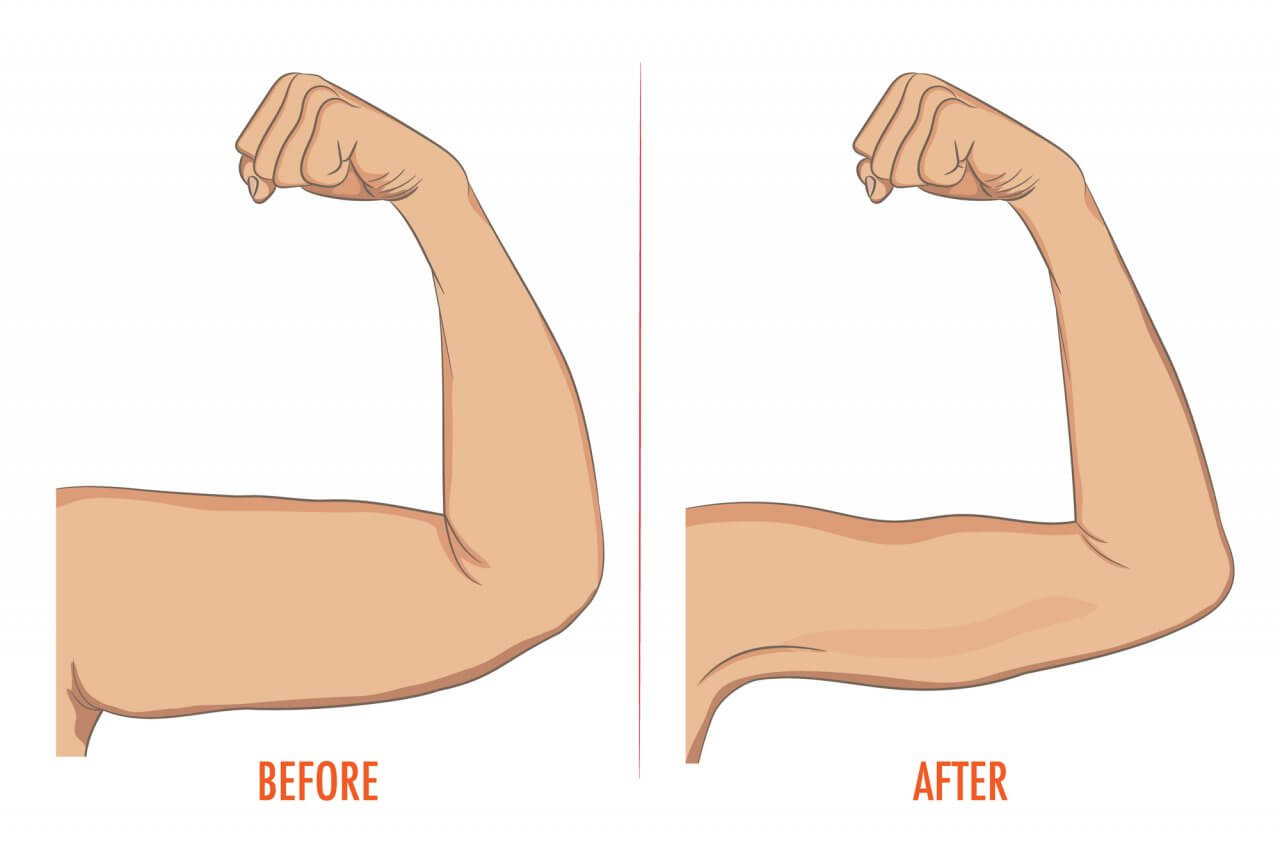 6 ejercicios para combatir la flacidez de los brazos