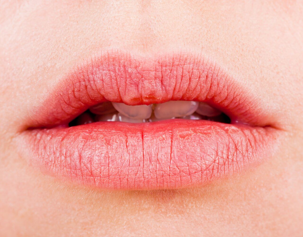 9 alternativas naturales para hidratar tus labios