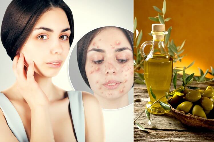 5 remedios caseros a base de aceite de oliva para la salud y belleza